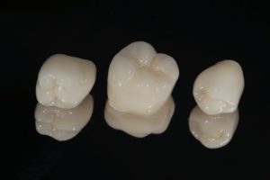 searing-toothaches-dental-crowns