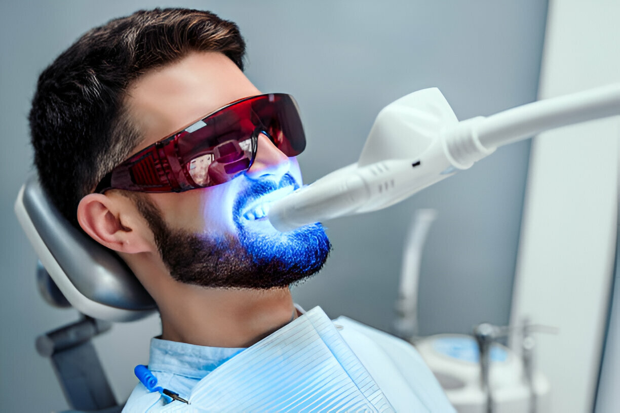 The Ultimate Teeth Discoloration Survival Guide: Tips and Tricks for a Whiter Smile