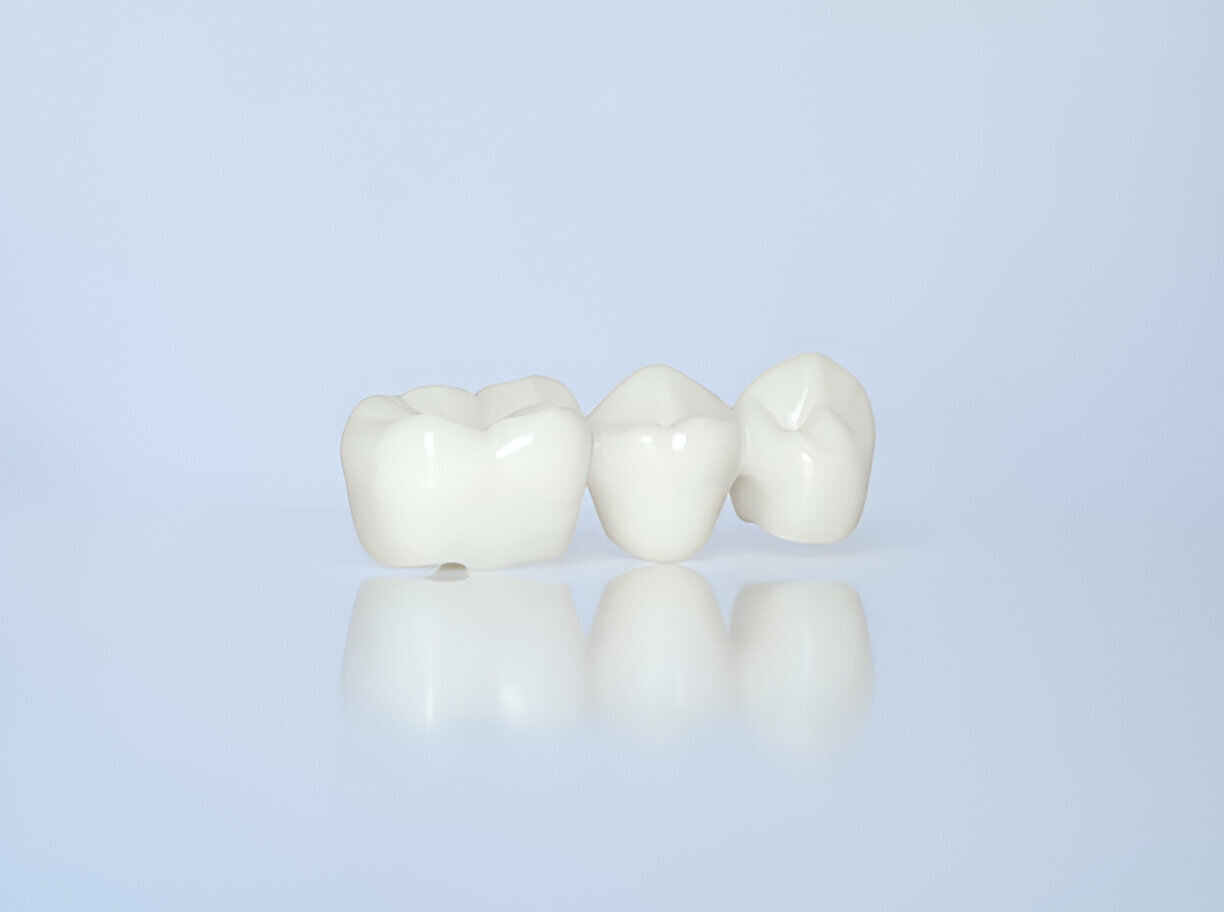 The Role of Dental Crowns in Restorative Dentistry: Insights from Grant D. Ringler, DDS_FI