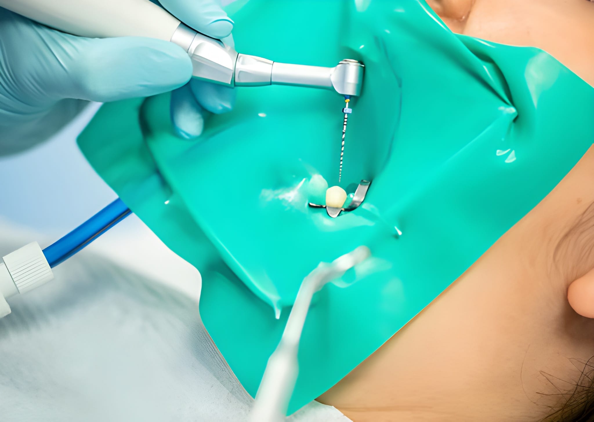 Why Patients Trust Grant D. Ringler, DDS for Root Canals in Hutchinson, KS_FI